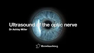 Optic nerve ultrasound