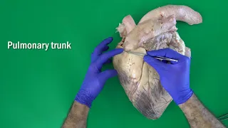 Anatomy of the Bovine Heart, Valves of the Heart