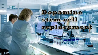 Dopamine Stem Cell Replacement for Parkinson's - SUMMARY