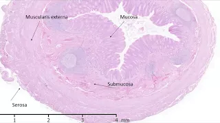 Histology of the Appendix