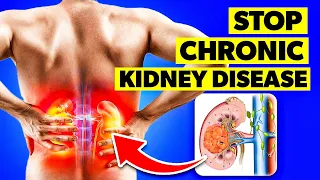 MOST Effective Chronic Kidney Disease Treatment Methods