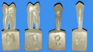 Carving of maxillary first premolar