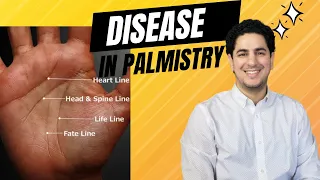 🖐 Signs of Disease on your Palm