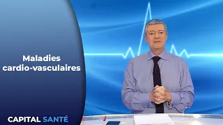 Maladies cardio-vasculaires : ce qu'il faut savoir - Capital Santé