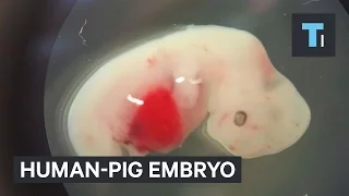 Scientists created the first human-pig embryo that could revolutionize healthcare