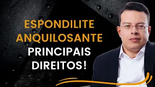 Espondilite Anquilosante - Conheça os principais direitos!