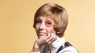 Sandy Duncan Reveals the Truth About Her Glass Eye