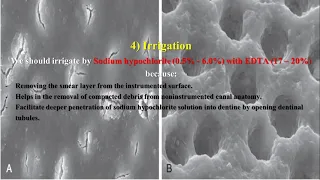 Evaluation of success and failure of endodontic treatment: Dr. Mohammad Busher Alawa