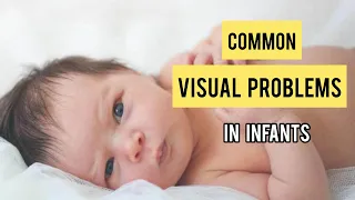 COMMON EYE PROBLEMS IN BABIES :RECOGNIZING SIGNS OF VISUAL PROBLEMS IN CHILDREN/INFANTS 2020