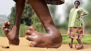 Life With Giant Feet : BORN DIFFERENT