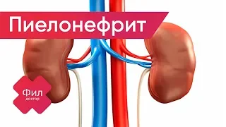 ПИЕЛОНЕФРИТ Лечение | Как лечить пиелонефрит почек дома | Симптомы пиелонефрита | Болит поясница