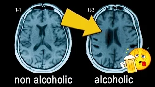 Does Alcohol KILL Brain Cells? - Debunking a Myth