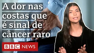 O câncer raro que tem dor nas costas como principal sintoma