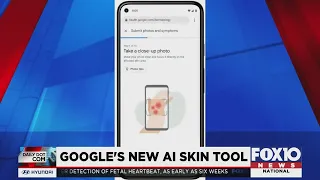 Using AI to help find answers to skin conditions