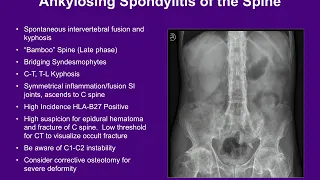 Inflammatory Conditions of the Spine - ABOS Orthopedic Surgery Board Exam Review