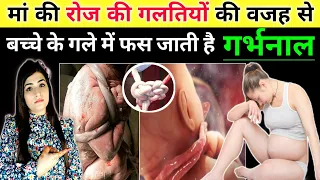 गर्भ में बच्चे के गले में गर्भनाल क्यों लिपट जाती है जाने कारण | Umbilical Cord Around Baby