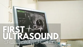 OUR FIRST ULTRASOUND + HEARING BABY'S HEARTBEAT| 6 WEEKS PREGNANT