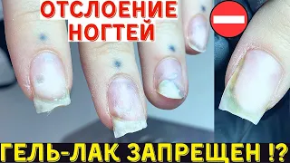 Это надо знать! Когда нельзя делать маникюр и покрытие гель лак?