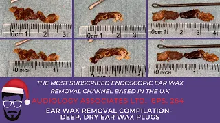 EAR WAX REMOVAL COMPILATION - DEEP DRY EAR WAX PLUGS - EP 264