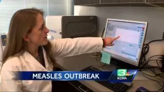 Measles outbreak prompts questions in Solano County