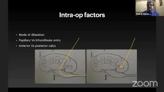 Bleeding During & After PCNL || Urology ||