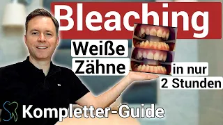 Professionelle Zahnaufhellung / Bleaching [Komplettguide]: Strahlend weiße Zähne in nur 2 Stunden!