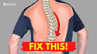 How to Relieve Your Scoliosis Back Pain in 30 SECONDS