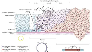 Molecular Diagnostics Hybrid capture and HPV detection