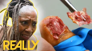 Granny Sacrifices Her Toenail To Play With Her Granddaughter Again | The Toe Bro