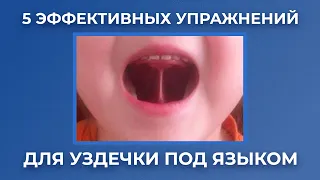 5 эффективных упражнений для уздечки под языком