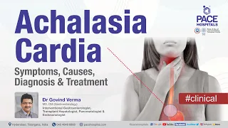 Achalasia Cardia - Symptoms, Causes, Diagnosis, Treatment | Motility Disorder of Esophagus