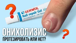 Ногти против гололеда, часть 2/ можно ли закрыть онихолизис материалом?/ протезирование ногтя