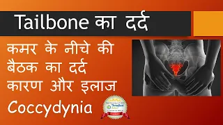 Tailbone का दर्द - कारण और इलाज । कमर के नीचे की बैठक का दर्द  Causes & Treatment : Coccydynia