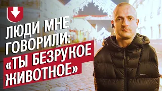 Охранник без рук: Денис | ВОПРЕКИ