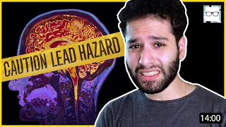 How LEAD POISONING Affects The Human Brain 🧠