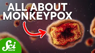 The Truth Behind Monkeypox