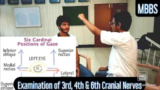 Examination of 3rd, 4th & 6th Cranial Nerves | MUHS | #mbbs #neetpg #practical #medicine #cns