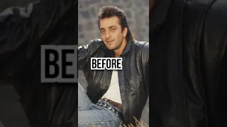 Before &After is Sanjay dutt 🙄😉#sanjaydutt #action#bollywoodmovies