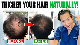 How to Treat Your Hair Loss The Holistic Way!