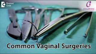 What are the most common surgeries done in women? - Dr. Nikhil D Datar of Cloudnine Hospitals