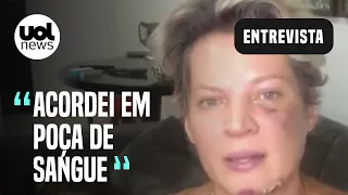 Joice Hasselmann relata suposto atentado: "Acordei em poça de sangue"