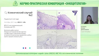 Цитологические категории «серой» зоны ASCUS, ASC H и их клиническое значение