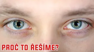 Jak "vycítíme", že na nás někdo zírá? - Proč to řešíme? #916