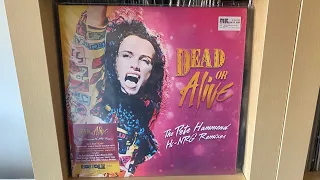 Dead Or Alive Pete Hammond Remixes RSD Vinyl [Unboxing]