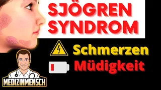 Schmerzen & Bleierne Müdigkeit Den Ganzen Tag 😴 POLYNEUROPATHIE beim Sjögren Syndrom (Arzt erklärt)