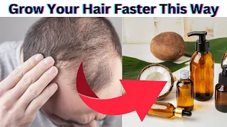10 Ultimate Guide To Re Grow Thinning Hair
