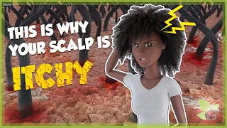Why your scalp is so damn ITCHY