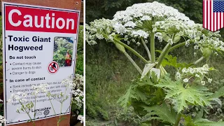 Giant hogweed found in Virginia can cause burns, blindness - TomoNews