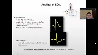 23. SINDROME CORONARIO   AGUDO SIN ELEVACION DEL SEGMENTO ST Y ANGINA CRONICA