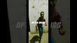 Soccer players before and after drugs *Mbappe edition* #shorts